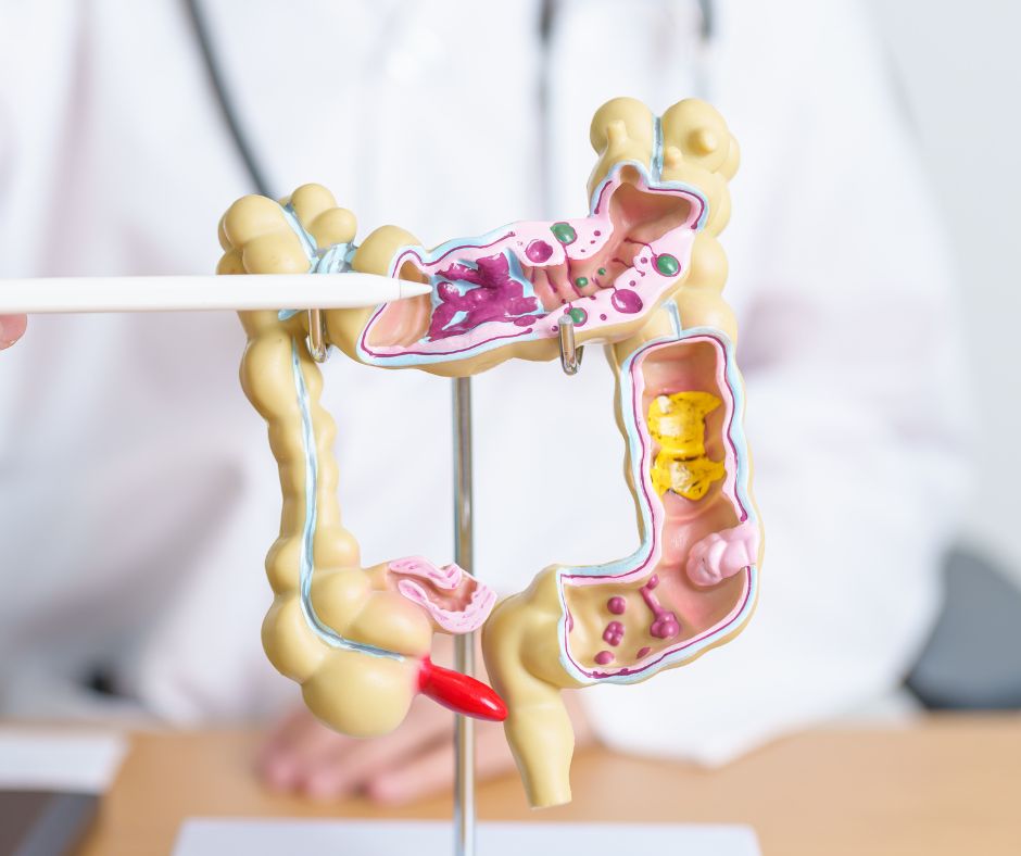 Fonti vegetali di omega 3 effetti collaterali